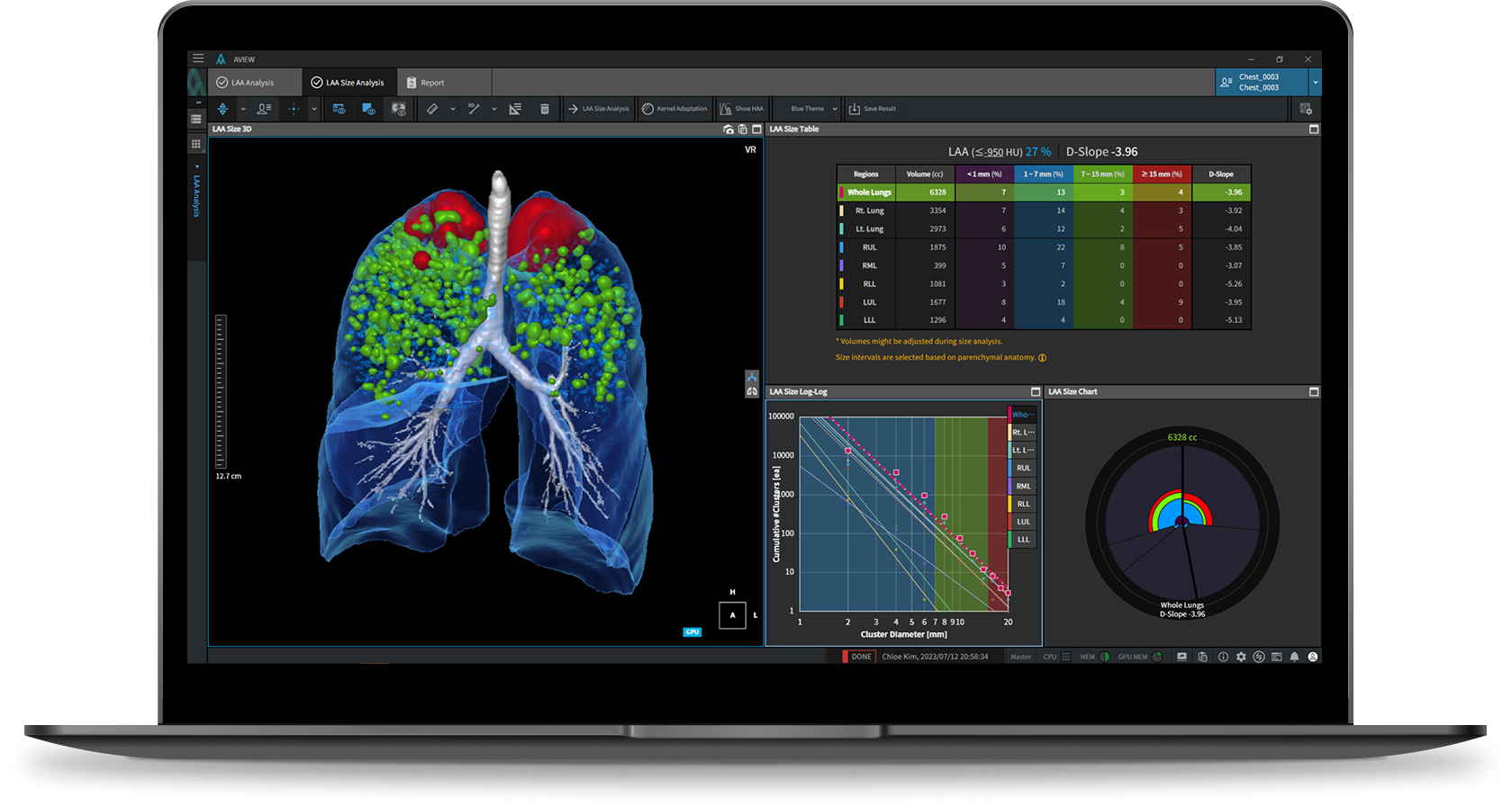aview COPD | Automated COPD Analysis AI Solution