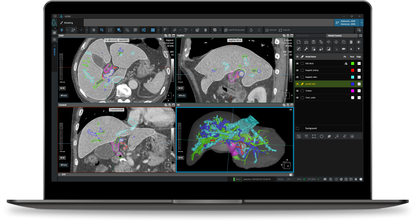 의료 영상 3D 모델링 & 프린팅 소프트웨어
