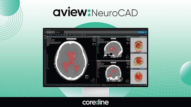 Coreline Soft starts non-reimbursable billing for its AI medical solution for brain hemorrhage.