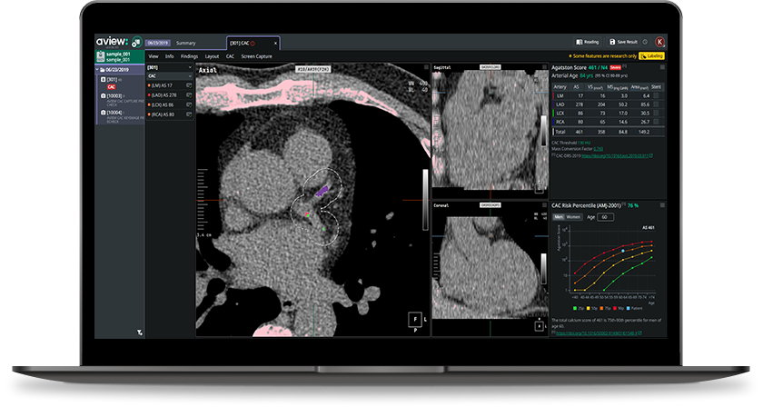 Coreline Soft's aview CAC
