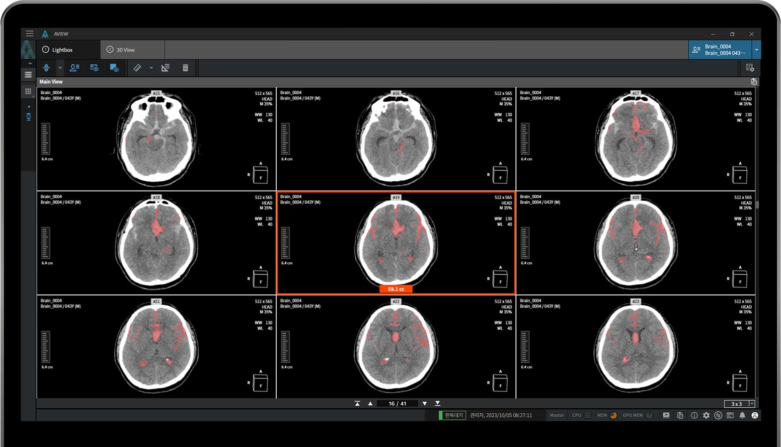 aview NeuroCAD Includes a 2D Viewer