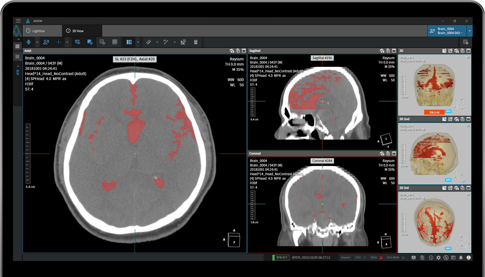aview NeuroCAD Includes a 3D Viewer