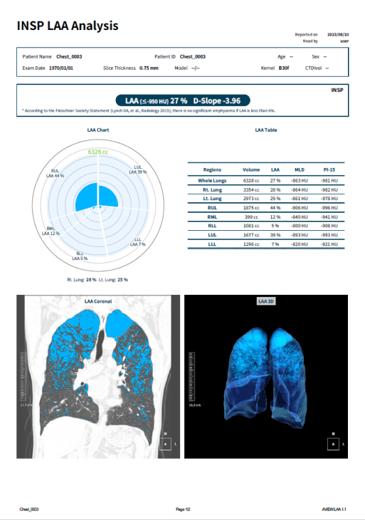 aview COPD | Delivering Comprehensive Analysis Results