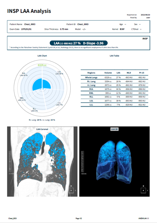 copd 리포트 이미지