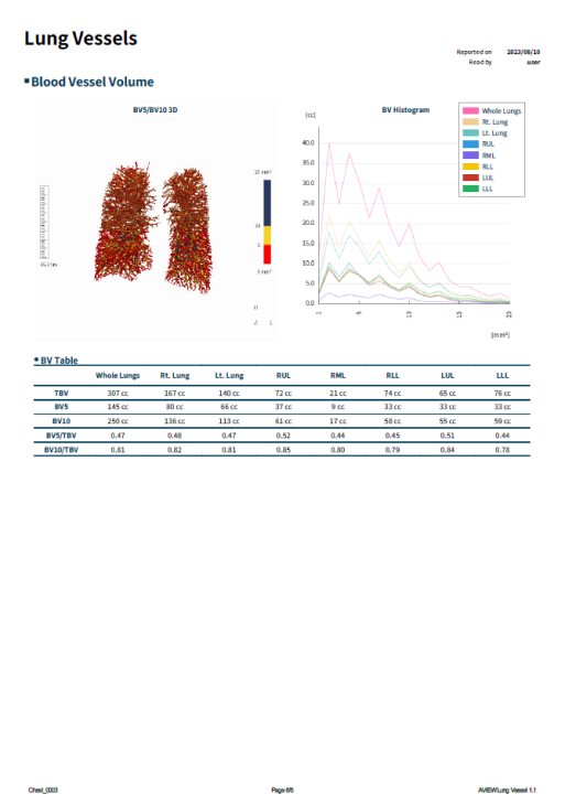 copd 리포트 이미지