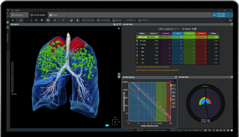 aview COPD | Emphysema Cluster Analysis