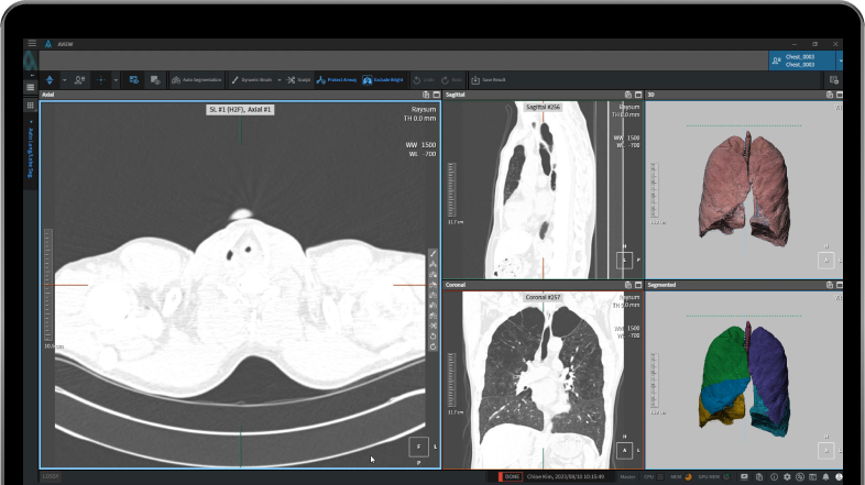 aview COPD | Automate preprocessing tasks