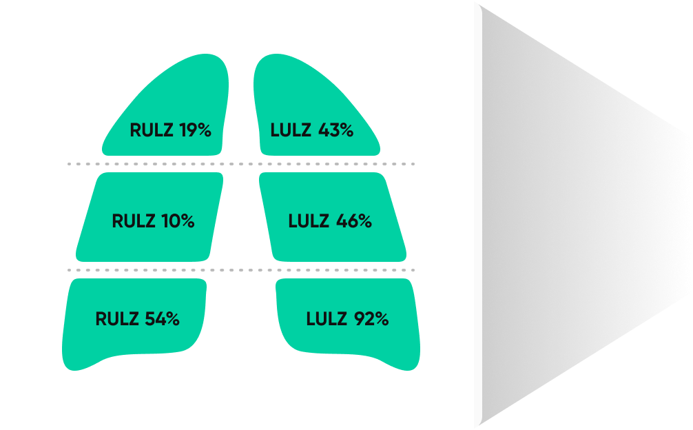 aview ILA Delivering Comprehensive Analysis Results popup