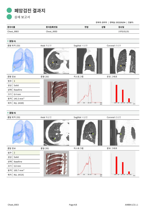 aview LCS | Automatically generated reports with detail assist patients understand examination results