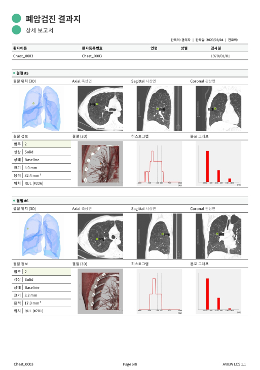 aview LCS | Automatically generated reports with detail assist patients understand examination results