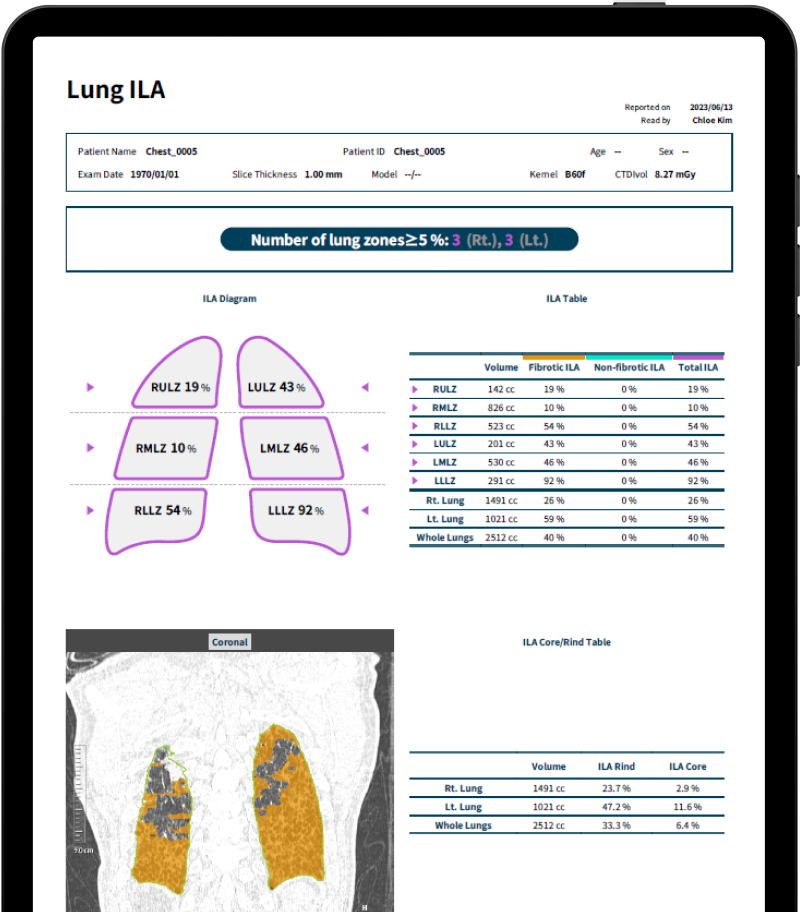 aview ILA Delivering Comprehensive Analysis Results