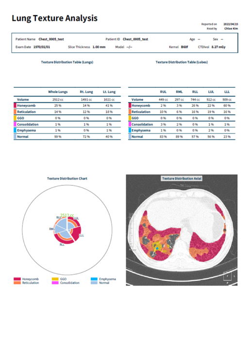 aview Lung Texture | Delivering Comprehensive Analysis Results