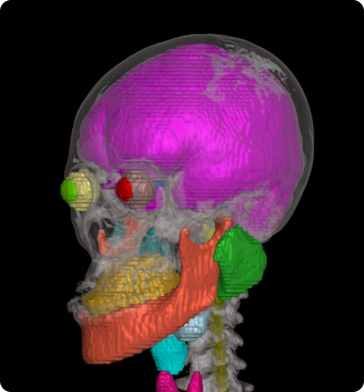 aview Modeler Automatically segment and contour organs with aview RT ACS Head & Neck