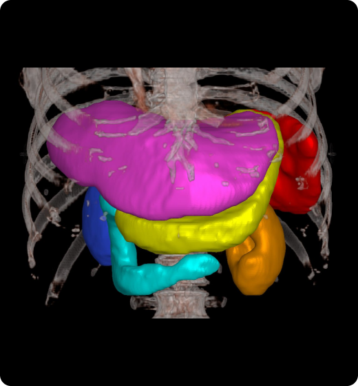 aview Modeler Automatically segment and contour organs with aview RT ACS Abdomen