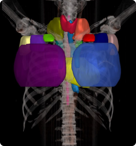 aview Modeler Automatically segment and contour organs with aview RT ACS Breast
