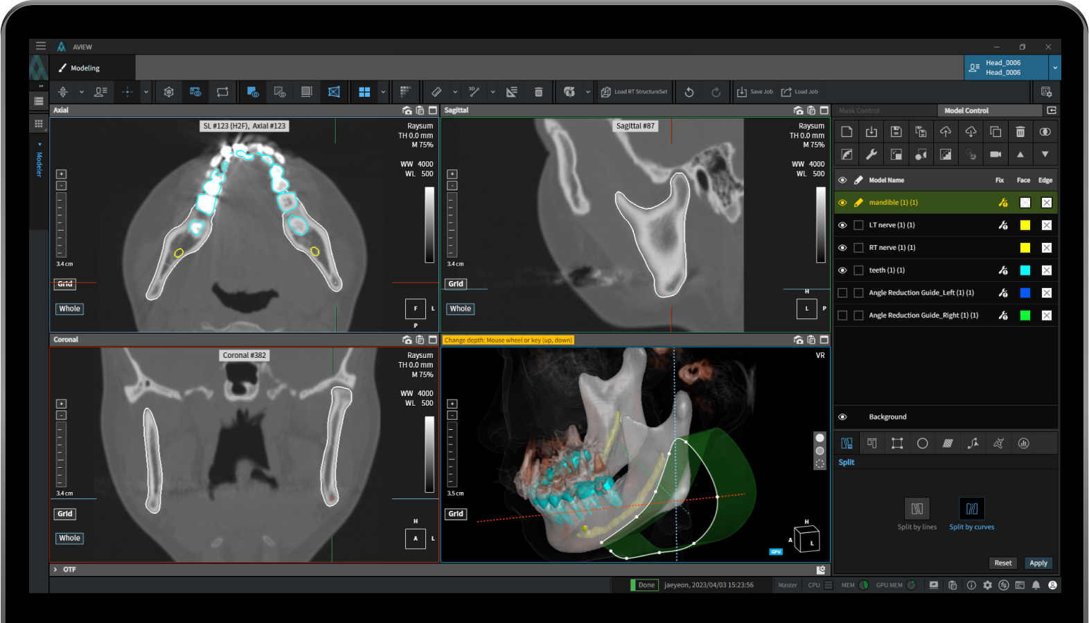 aview modeler Split Model