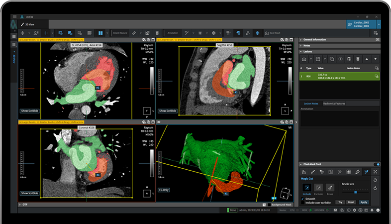 aview Research Key features Magic cut segmentation