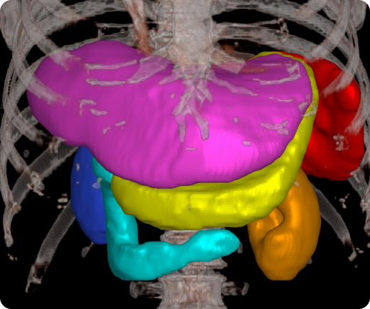 aview RT ACS Automate organ segmentation Abdomen