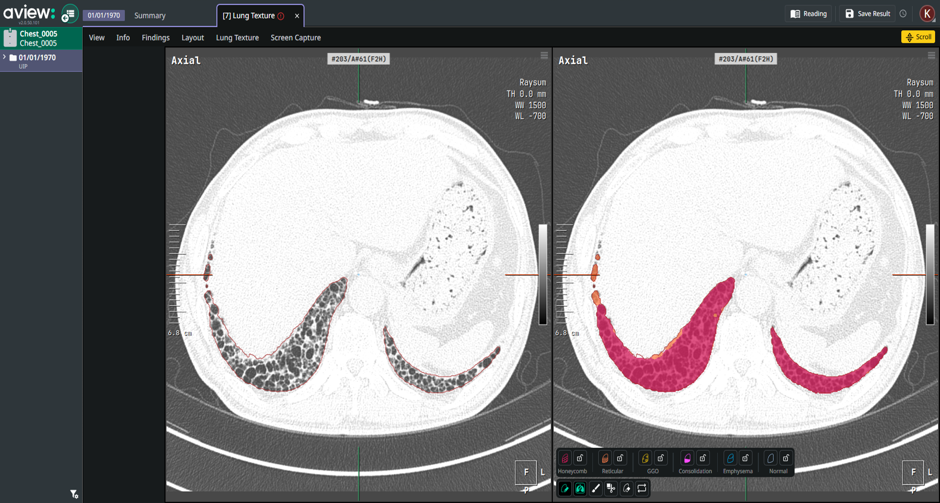 패턴 비교 & 수정 이미지