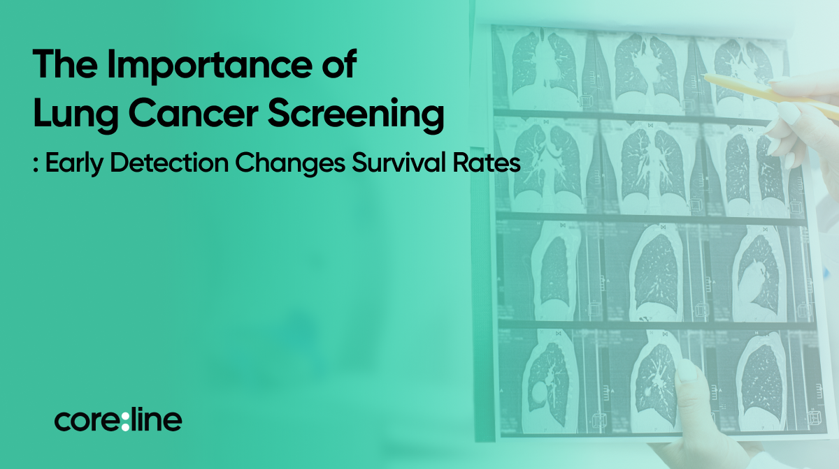 The Importance of Lung Cancer Screening: Early Detection Changes Survival Rates