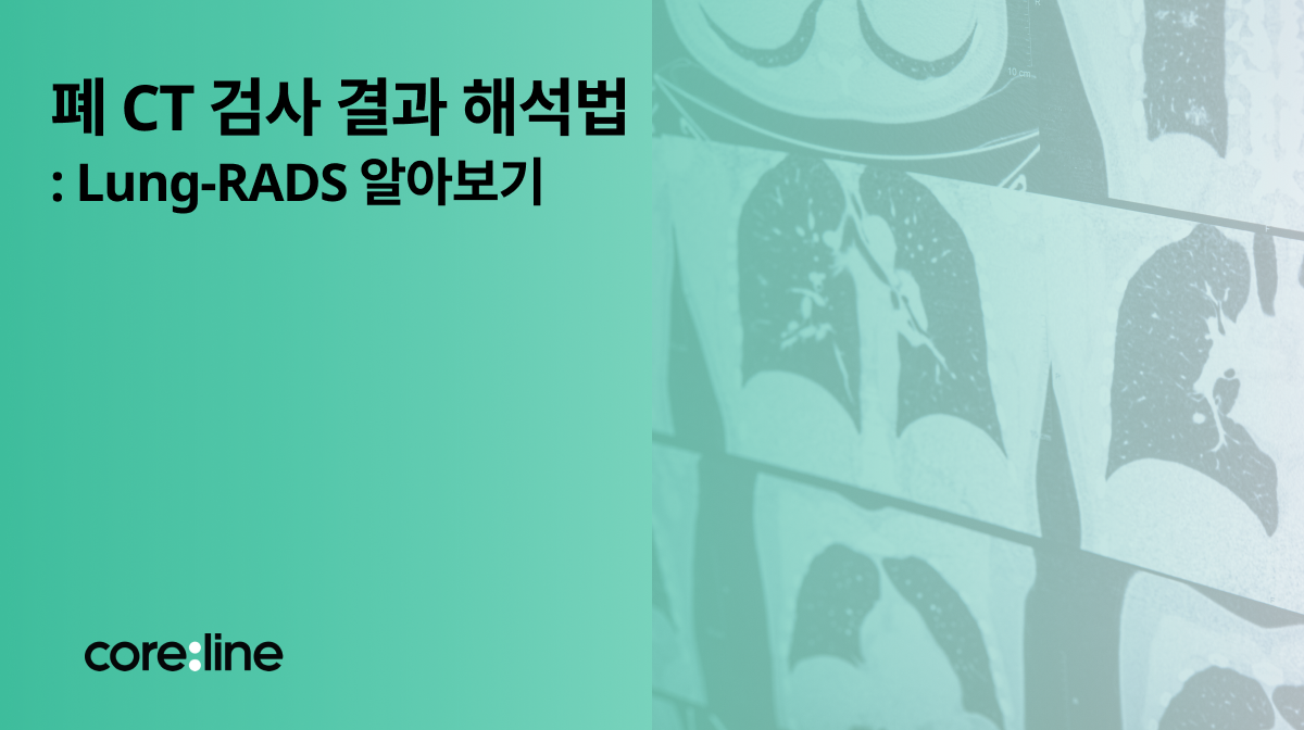 폐 CT 검사 결과 해석법: Lung-RADS 알아보기