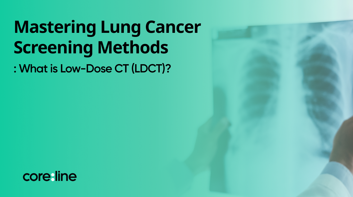 Mastering Lung Cancer Screening Methods: What is Low-Dose CT (LDCT)?