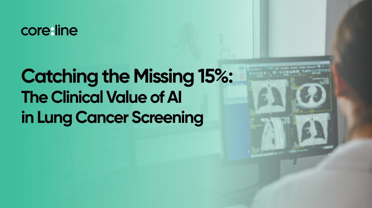 Catching the Missing 15%: The Clinical Value of AI in Lung Cancer Screening