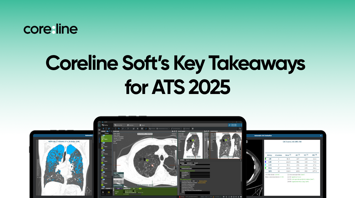 How Coreline Soft Supports AI-Based Chest CT Interpretation at ATS 2025