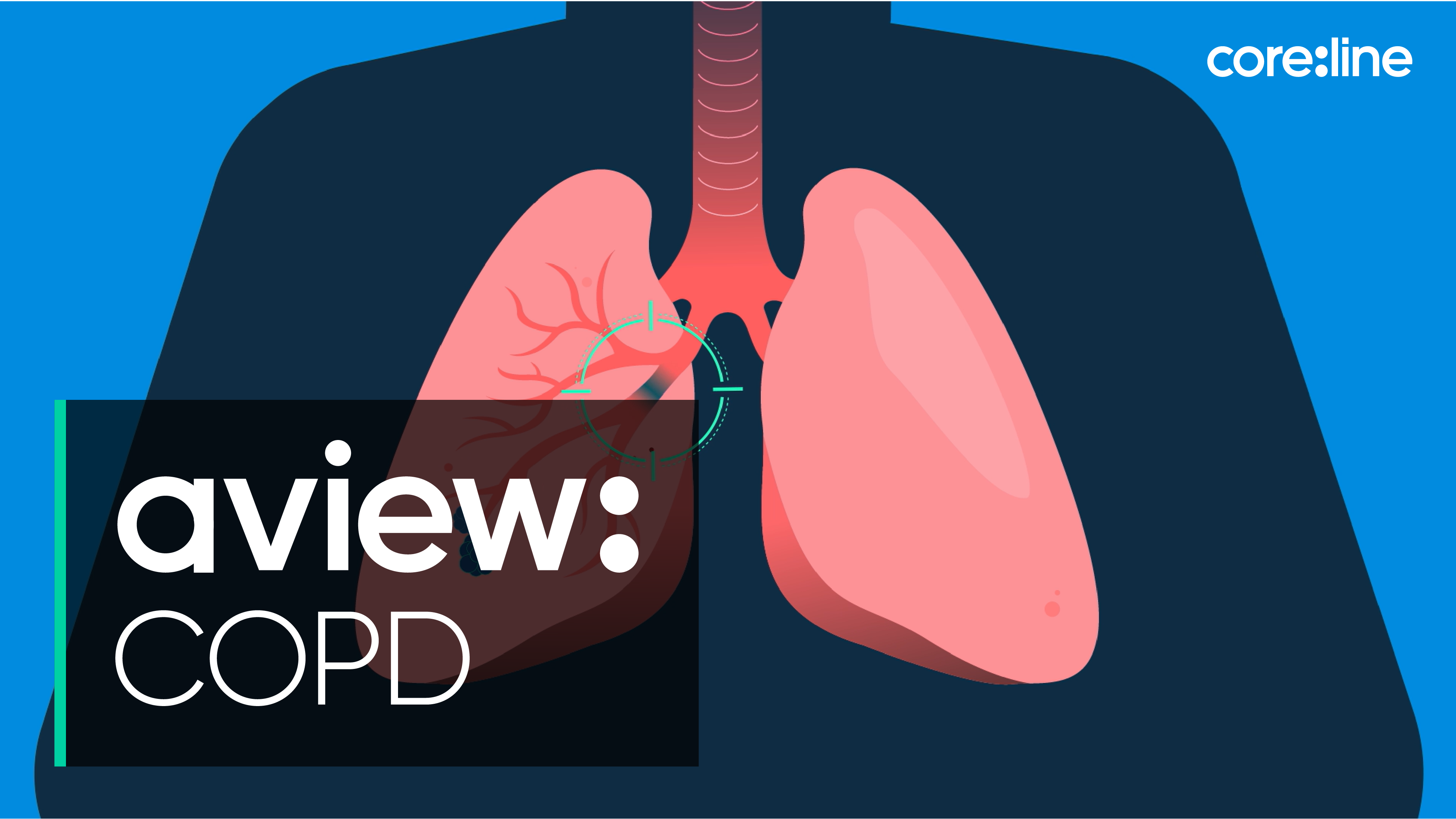 Chronic Obstructive Pulmonary Disease Solution