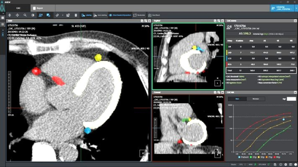 Coreline Soft & 3DR Labs Strengthen Partnership to Accelerate US Expansion in AI-Powered 3D Medical Imaging
