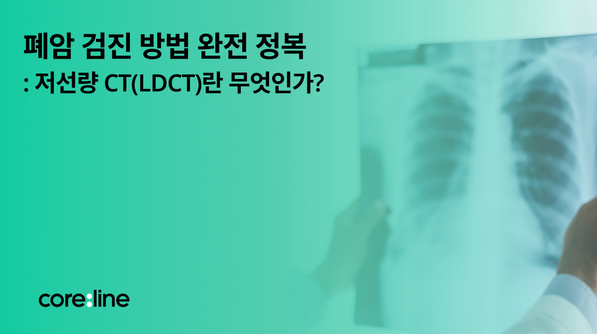 폐암 검진 방법 완전 정복: 저선량 CT(LDCT)란 무엇인가?