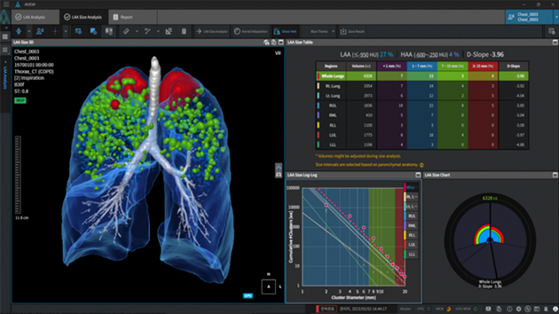 코어라인소프트, 유럽 대형 병원·영상센터에 AI 솔루션 공급