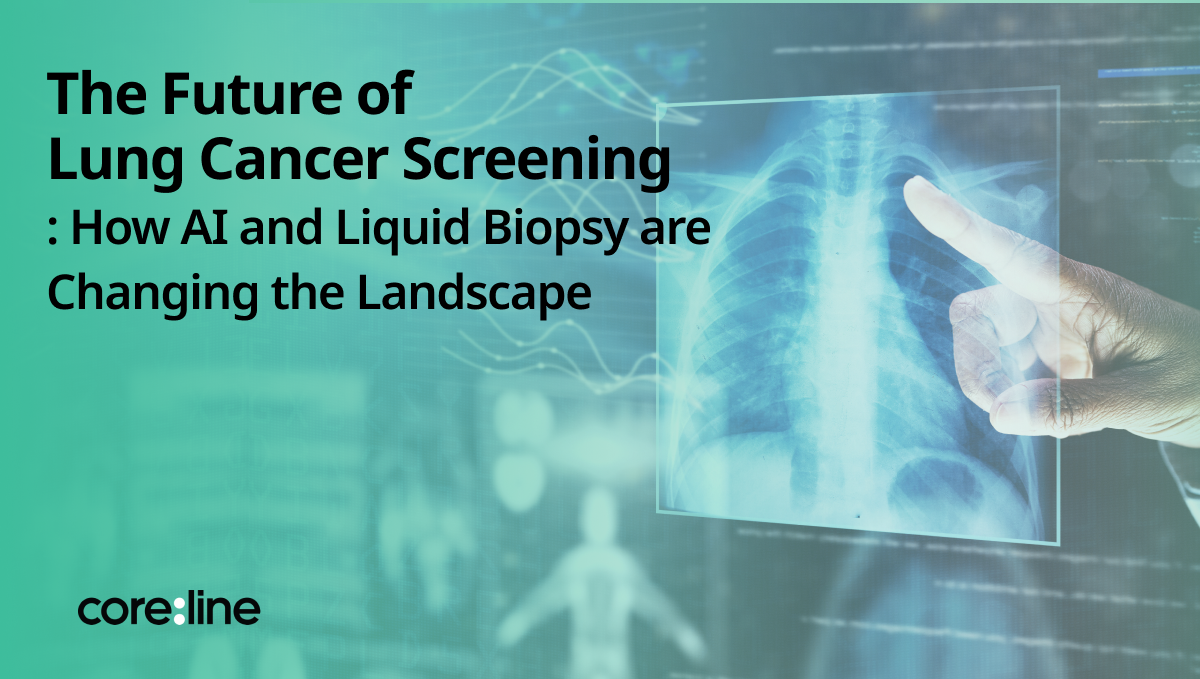 The Future of Lung Cancer Screening: How AI and Liquid Biopsy are Changing the Landscape