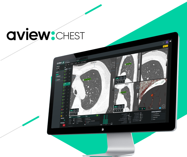 화순전남대학교 폐암진단에 활용되는 AVIEW Chest