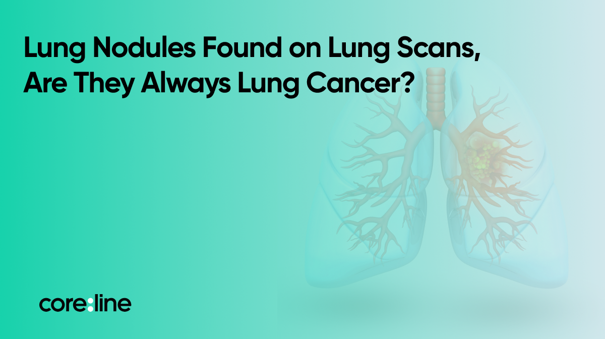Lung Nodules Found on Lung Scans – Are They Always Lung Cancer?