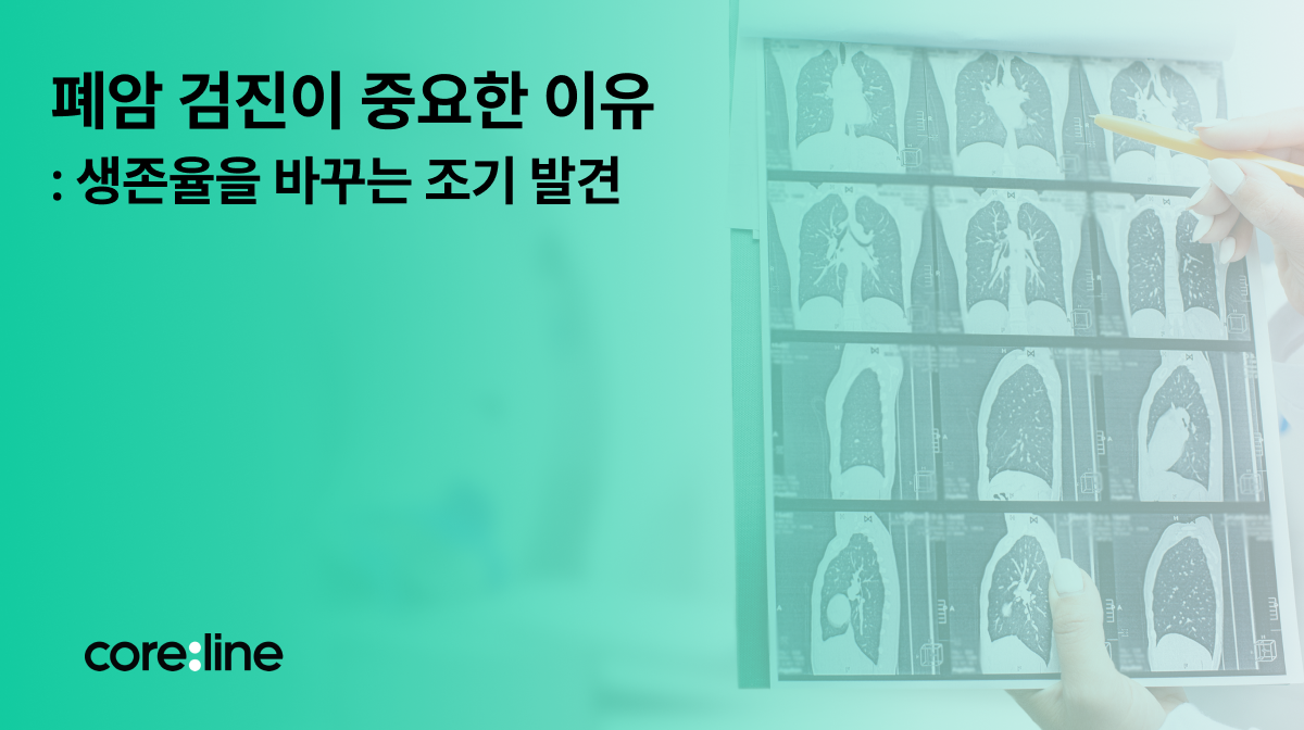 폐 스캔에서 발견되는 폐 결절, 꼭 폐암일까?