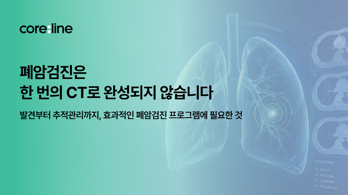 폐암검진은 한 번의 CT로 완성되지 않습니다