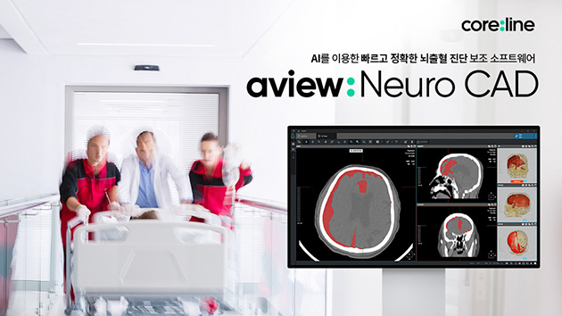 혁신의료기술 ‘AVIEW Neuro CAD’ 뇌출혈 진단 AI로 각광