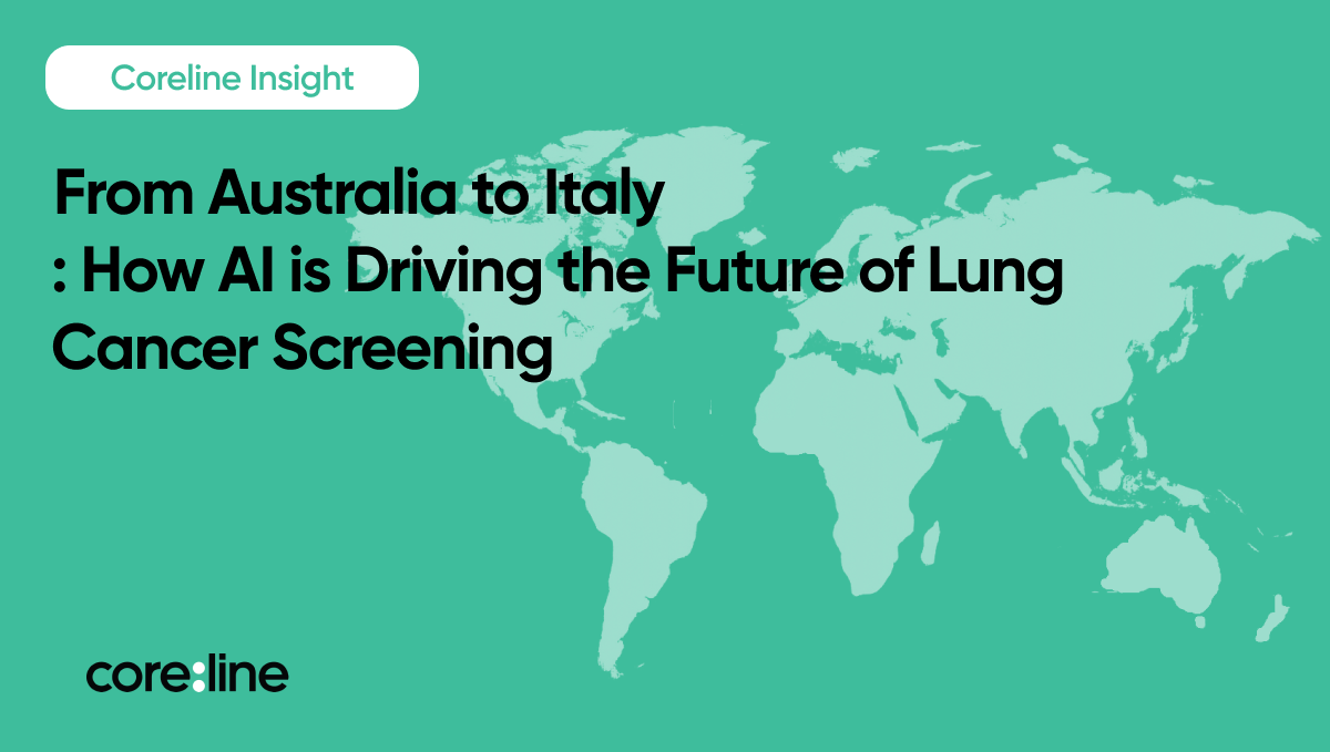 From Australia to Italy: How AI is Driving the Global Evolution of Lung Cancer Screening