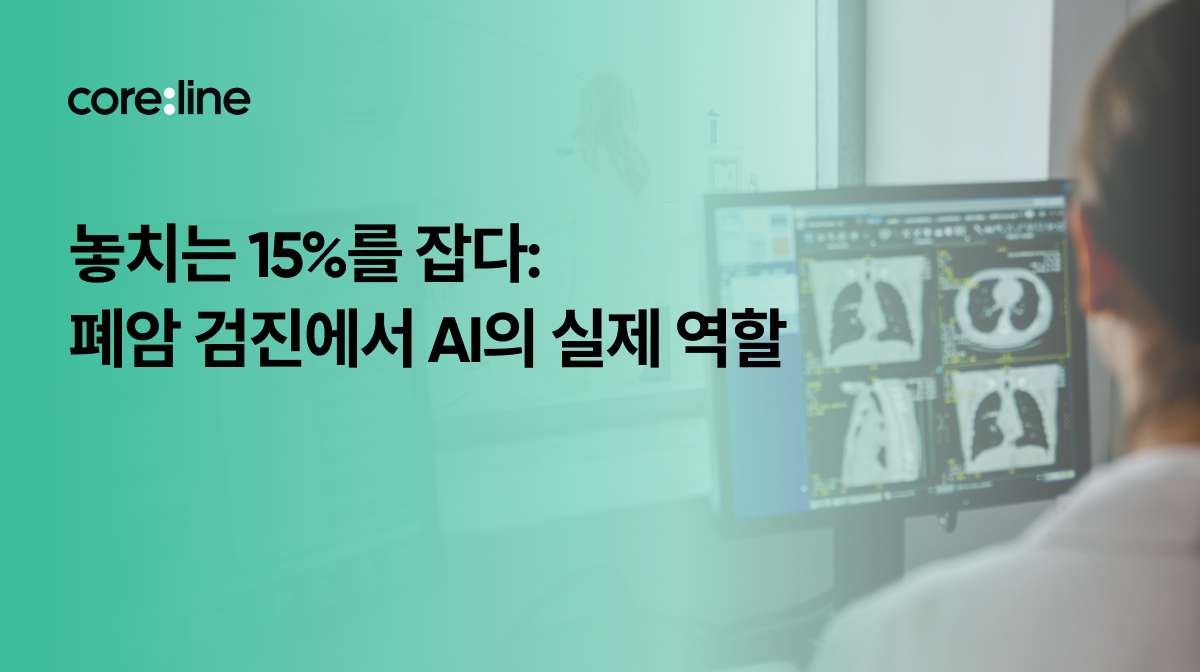 놓치는 15%를 잡다: 폐암 검진에서 AI의 실제 역할
