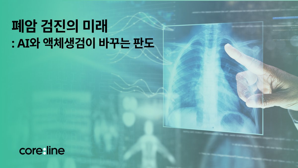 폐암 검진의 미래: AI·액체생검이 바꾸는 판도